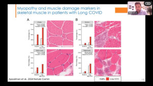 Dr. Rob Wüst: Muskelfunktion und Post-Exertional Malaise bei Long Covid